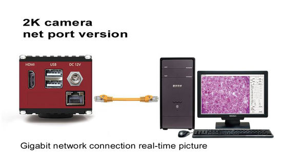 기가비트 네트워크 인터페이스와 HDMI 60FPS 현미경 디지털 카메라